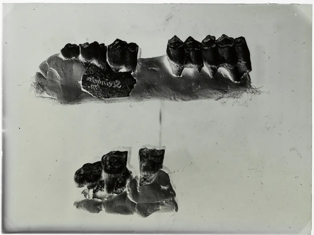 The image shows a black and white photo of a pair of teeth on a white background. The teeth are...